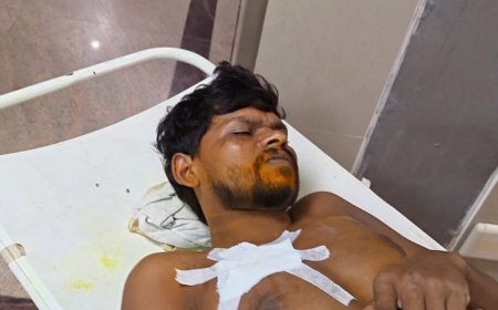 Jamshedpur crime: टेल्को में मामूली कहासुनी में खूनी संघर्ष, मजदूर पर चाकू से हमला