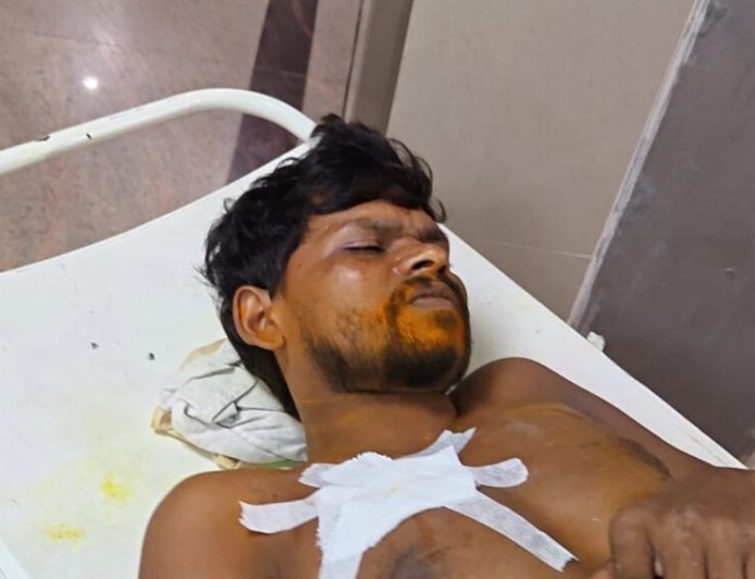 Jamshedpur crime: टेल्को में मामूली कहासुनी में खूनी संघर्ष, मजदूर पर चाकू से हमला
