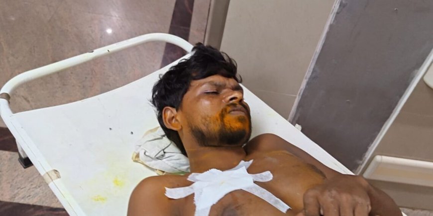Jamshedpur crime: टेल्को में मामूली कहासुनी में खूनी संघर्ष, मजदूर पर चाकू से हमला
